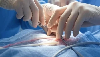 Кубанские врачи освоили революционный способ лечения опухолей